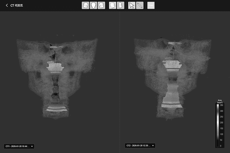 CT 자동 진단 프로그램